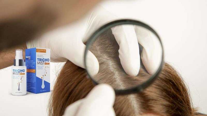 Trichomist-anchor: Gdzie znaleźć najlepsze oferty?, trichomist forte allegro